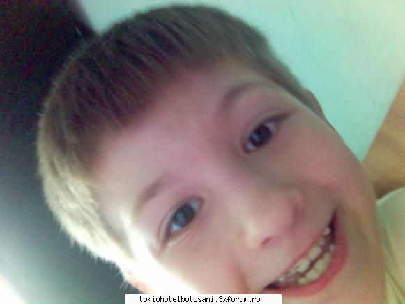 deci pun una cand cazut bucatarie cu&nbsp; fata scaun si'a spart radeti cat puteti are fata vaii